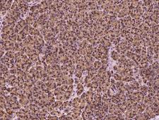 HEATR4 Antibody - Immunochemical staining of human HEATR4 in human pancreas with rabbit polyclonal antibody at 1:100 dilution, formalin-fixed paraffin embedded sections.