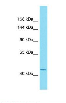 HEATR6 / ABC1 Antibody - Western blot of Human 721_B. HEATR6 antibody dilution 1.0 ug/ml.  This image was taken for the unconjugated form of this product. Other forms have not been tested.
