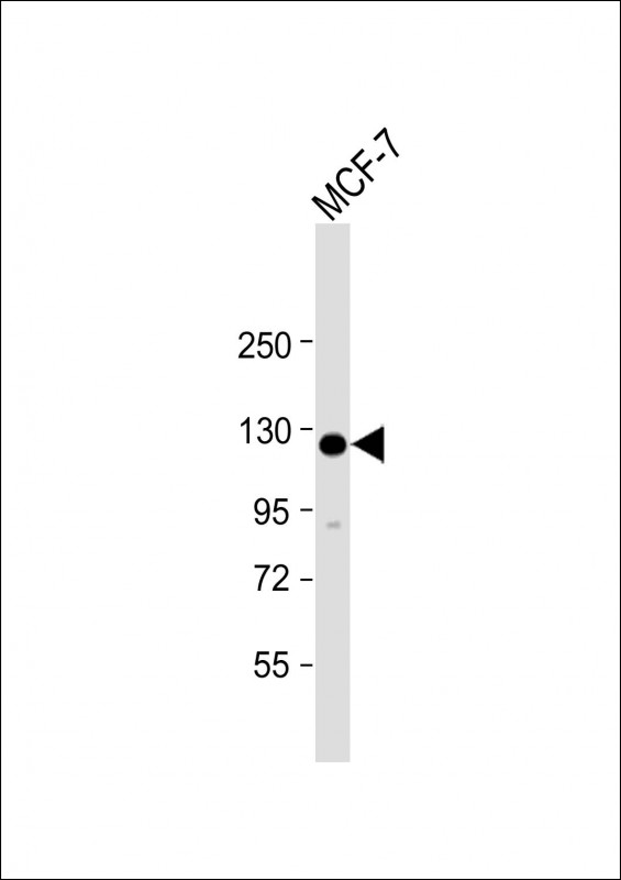 HEATR6 / ABC1 Antibody - Anti-HEATR6 Antibody (N-Term) at 1:2000 dilution + MCF-7 whole cell lysate Lysates/proteins at 20 µg per lane. Secondary Goat Anti-Rabbit IgG, (H+L), Peroxidase conjugated at 1/10000 dilution. Predicted band size: 129 kDa Blocking/Dilution buffer: 5% NFDM/TBST.