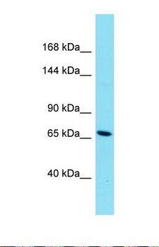 HEATR8 Antibody - Western blot of A549. HNRNPC antibody dilution 1.0 ug/ml.  This image was taken for the unconjugated form of this product. Other forms have not been tested.