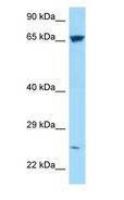 HEATR9 Antibody - C17orf66 antibody Western Blot of 293T.  This image was taken for the unconjugated form of this product. Other forms have not been tested.