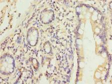 HEATR9 Antibody - Immunohistochemistry of paraffin-embedded human small intestine tissue using antibody at dilution of 1:100.
