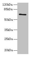 HEATR9 Antibody - Western blot All lanes: HEATR9 antibody at 1.2µg/ml + Jurkat whole cell lysate Secondary Goat polyclonal to rabbit IgG at 1/10000 dilution Predicted band size: 66, 27, 61, 45, 40 kDa Observed band size: 66 kDa