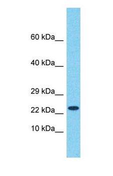 HEBP1 Antibody - Western blot of HEBP1 Antibody with Fetal Kidney lysate.  This image was taken for the unconjugated form of this product. Other forms have not been tested.