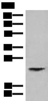 HEBP1 Antibody - Western blot analysis of Human kidney tissue lysate  using HEBP1 Polyclonal Antibody at dilution of 1:750