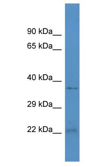 HEBP2 Antibody - HEBP2 antibody Western Blot of Rat Lung. Antibody dilution: 1 ug/ml.  This image was taken for the unconjugated form of this product. Other forms have not been tested.