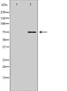 HEC1 / NDC80 Antibody - Western blot analysis of K562 whole cells lysates using NDC80 antibody. The lane on the left is treated with the antigen-specific peptide.