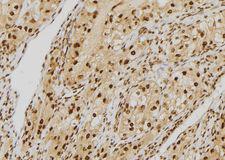 HEC1 / NDC80 Antibody - 1:100 staining human kidney tissue by IHC-P. The sample was formaldehyde fixed and a heat mediated antigen retrieval step in citrate buffer was performed. The sample was then blocked and incubated with the antibody for 1.5 hours at 22°C. An HRP conjugated goat anti-rabbit antibody was used as the secondary.
