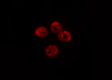 HEC1 / NDC80 Antibody - Staining HeLa cells by IF/ICC. The samples were fixed with PFA and permeabilized in 0.1% Triton X-100, then blocked in 10% serum for 45 min at 25°C. The primary antibody was diluted at 1:200 and incubated with the sample for 1 hour at 37°C. An Alexa Fluor 594 conjugated goat anti-rabbit IgG (H+L) antibody, diluted at 1/600, was used as secondary antibody.