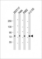 HEC1 / NDC80 Antibody - All lanes: Anti-NDC80 Antibody (C-Term) at 1:2000 dilution Lane 1: 293T/17 whole cell lysate Lane 2: Hela whole cell lysate Lane 3: K562 whole cell lysate Lane 4: U-2 OS whole cell lysate Lysates/proteins at 20 µg per lane. Secondary Goat Anti-Rabbit IgG, (H+L), Peroxidase conjugated at 1/10000 dilution. Predicted band size: 74 kDa Blocking/Dilution buffer: 5% NFDM/TBST.