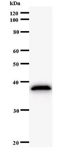 HEC1 / NDC80 Antibody - Western blot of immunized recombinant protein using KNTC2 antibody.