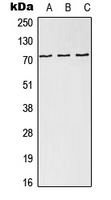 HEC1 / NDC80 Antibody - Western blot analysis of NDC80 expression in HEK293T (A); SP2/0 (B); H9C2 (C) whole cell lysates.