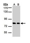 HEC1 / NDC80 Antibody - Sample. A: 30g of A431 whole cell lysate. B: 30g of H1299 whole cell lysate. 7.5% SDS PAGE. NDC80 antibody diluted at 1:1000