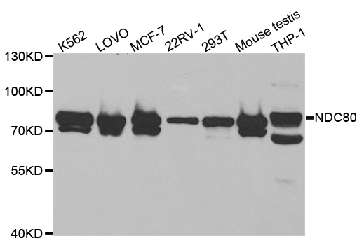 HEC1 / NDC80 Antibody - Western blot analysis of extracts of various cell lines, using NDC80 antibody.