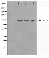 HEC1 / NDC80 Antibody - Western blot of Jurkat,A549 and HUVEC cell lysate using HEC1 Antibody