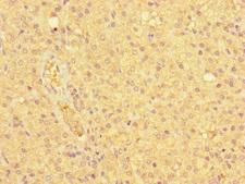 HEC1 / NDC80 Antibody - Immunohistochemistry of paraffin-embedded human adrenal gland tissue at dilution of 1:100