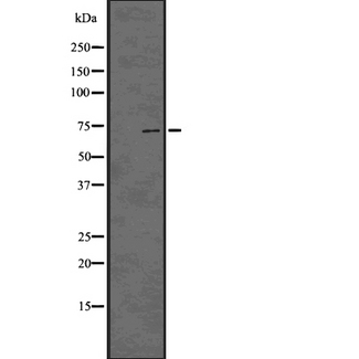 HEC1 / NDC80 Antibody - Western blot analysis of KNTC2 using 293 whole cells lysates
