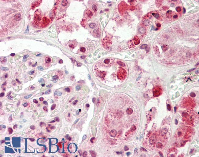 HECTD2 Antibody - Anti-HECTD2 antibody IHC staining of human kidney. Immunohistochemistry of formalin-fixed, paraffin-embedded tissue after heat-induced antigen retrieval. Antibody concentration 10 ug/ml.  This image was taken for the unconjugated form of this product. Other forms have not been tested.