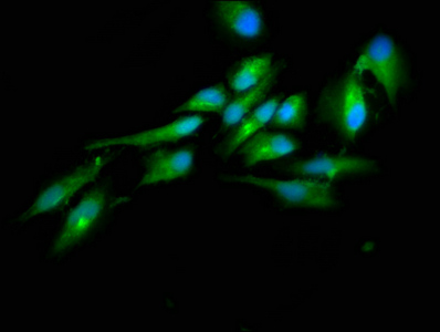 HECTD2 Antibody - Immunofluorescence staining of Hela cells at a dilution of 1:100, counter-stained with DAPI. The cells were fixed in 4% formaldehyde, permeabilized using 0.2% Triton X-100 and blocked in 10% normal Goat Serum. The cells were then incubated with the antibody overnight at 4 °C.The secondary antibody was Alexa Fluor 488-congugated AffiniPure Goat Anti-Rabbit IgG (H+L) .
