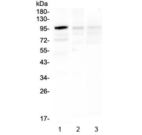 HECTD3 Antibody - Western blot testing of 1) human Caco-2, 2) rat brain and 3) mouse brain lysate with HECTD3 antibody at 0.5ug/ml. Predicted molecular weight ~97 kDa.