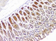 HECTD3 Antibody - IHC staining of FFPE human stomach tissue with HECTD3 antibody at 1ug/ml. HIER: boil tissue sections in pH6, 10mM citrate buffer, for 10-20 min and allow to cool before testing.