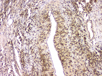 HECTD3 Antibody - IHC staining of FFPE human lung tissue with HECTD3 antibody at 1ug/ml. HIER: boil tissue sections in pH6, 10mM citrate buffer, for 10-20 min and allow to cool before testing.