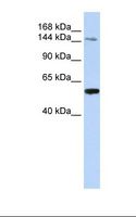 HEDLS / EDC4 Antibody - Fetal liver lysate. Antibody concentration: 1.0 ug/ml. Gel concentration: 6-18%.  This image was taken for the unconjugated form of this product. Other forms have not been tested.