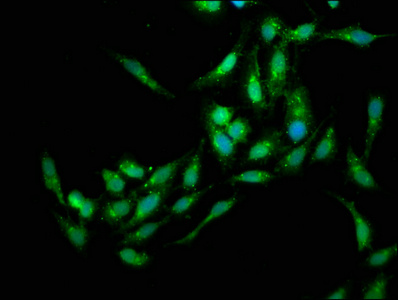 HEDLS / EDC4 Antibody - Immunofluorescence staining of Hela cells at a dilution of 1:133, counter-stained with DAPI. The cells were fixed in 4% formaldehyde, permeabilized using 0.2% Triton X-100 and blocked in 10% normal Goat Serum. The cells were then incubated with the antibody overnight at 4 °C.The secondary antibody was Alexa Fluor 488-congugated AffiniPure Goat Anti-Rabbit IgG (H+L) .