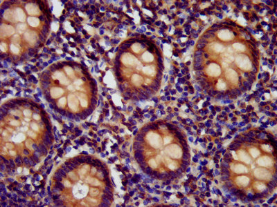 HEDLS / EDC4 Antibody - Immunohistochemistry image at a dilution of 1:400 and staining in paraffin-embedded human appendix tissue performed on a Leica BondTM system. After dewaxing and hydration, antigen retrieval was mediated by high pressure in a citrate buffer (pH 6.0) . Section was blocked with 10% normal goat serum 30min at RT. Then primary antibody (1% BSA) was incubated at 4 °C overnight. The primary is detected by a biotinylated secondary antibody and visualized using an HRP conjugated SP system.