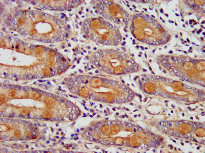 HEDLS / EDC4 Antibody - Immunohistochemistry image at a dilution of 1:400 and staining in paraffin-embedded human small intestine tissue performed on a Leica BondTM system. After dewaxing and hydration, antigen retrieval was mediated by high pressure in a citrate buffer (pH 6.0) . Section was blocked with 10% normal goat serum 30min at RT. Then primary antibody (1% BSA) was incubated at 4 °C overnight. The primary is detected by a biotinylated secondary antibody and visualized using an HRP conjugated SP system.