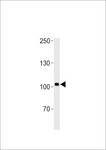 HEG1 Antibody - DANRE heg Antibody western blot of zebra fish muscle tissue lysates (35 ug/lane). The DANRE heg antibody detected the DANRE heg protein (arrow).
