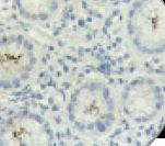 Helicobacter pylori Antibody - IHC of Helicobacter pylori on FFPE Infected Stomach tissue.