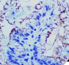 Helicobacter pylori Antibody - IHC of Helicobacter pylori on Stomach tissue.