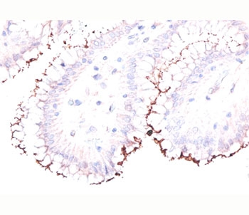 Helicobacter pylori Antibody - Formalin/paraffin human stomach stained with Helicobacter pylori antibody.