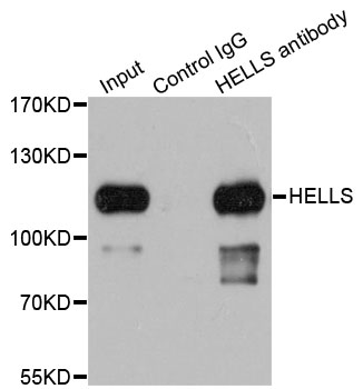 HELLS Antibody - Immunoprecipitation analysis of 200ug extracts of 293T cells.