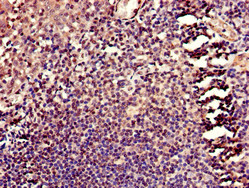HELLS Antibody - Immunohistochemistry of paraffin-embedded human tonsil tissue using HELLS Antibody at dilution of 1:100