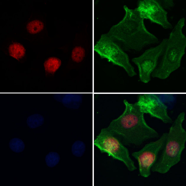 HELLS Antibody - Staining HeLa cells by IF/ICC. The samples were fixed with PFA and permeabilized in 0.1% Triton X-100, then blocked in 10% serum for 45 min at 25°C. Samples were then incubated with primary Ab(1:200) and mouse anti-beta tubulin Ab(1:200) for 1 hour at 37°C. An AlexaFluor594 conjugated goat anti-rabbit IgG(H+L) Ab(1:200 Red) and an AlexaFluor488 conjugated goat anti-mouse IgG(H+L) Ab(1:600 Green) were used as the secondary antibod