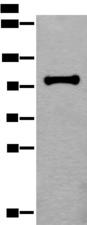 HELLS Antibody - Western blot analysis of HEPG2 cell lysate  using HELLS Polyclonal Antibody at dilution of 1:400