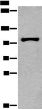 HELLS Antibody - Western blot analysis of HEPG2 cell lysate  using HELLS Polyclonal Antibody at dilution of 1:800