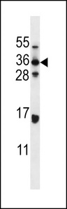 HELO1 / ELOVL5 Antibody - ELOVL5 Antibody western blot of MDA-MB435 cell line lysates (35 ug/lane). The ELOVL5 antibody detected the ELOVL5 protein (arrow).
