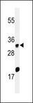 HELO1 / ELOVL5 Antibody - Western blot of ELOVL5 Antibody in HeLa cell line lysates (35 ug/lane). ELOVL5 (arrow) was detected using the purified antibody.