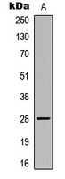HELO1 / ELOVL5 Antibody - Western blot analysis of ELOVL5 expression in HeLa (A) whole cell lysates.