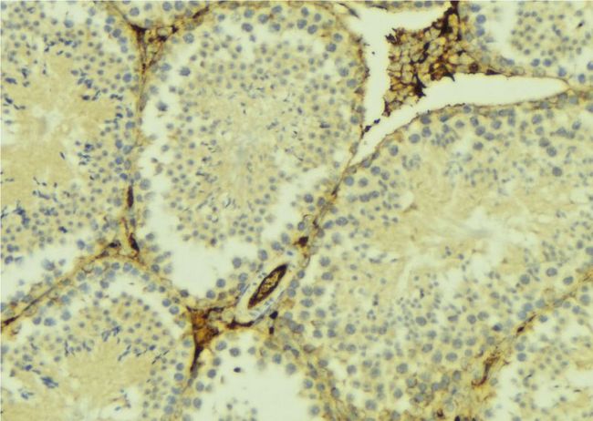 HELO1 / ELOVL5 Antibody - 1:100 staining mouse testis tissue by IHC-P. The sample was formaldehyde fixed and a heat mediated antigen retrieval step in citrate buffer was performed. The sample was then blocked and incubated with the antibody for 1.5 hours at 22°C. An HRP conjugated goat anti-rabbit antibody was used as the secondary.