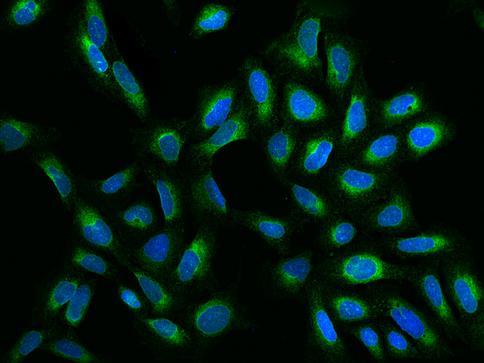 HELO1 / ELOVL5 Antibody - Immunofluorescence staining of ELOVL5 in U2OS cells. Cells were fixed with 4% PFA, permeabilzed with 0.1% Triton X-100 in PBS, blocked with 10% serum, and incubated with rabbit anti-Human ELOVL5 polyclonal antibody (dilution ratio 1:200) at 4°C overnight. Then cells were stained with the Alexa Fluor 488-conjugated Goat Anti-rabbit IgG secondary antibody (green) and counterstained with DAPI (blue). Positive staining was localized to Cytoplasm.