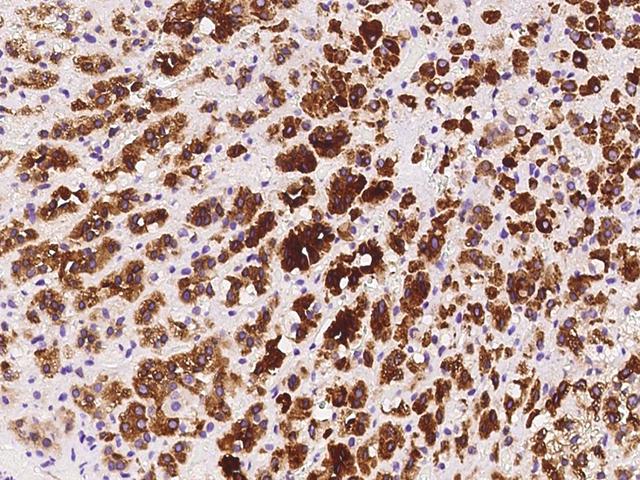 HELO1 / ELOVL5 Antibody - Immunochemical staining of human ELOVL5 in human adrenal gland with rabbit polyclonal antibody at 1:200 dilution, formalin-fixed paraffin embedded sections.