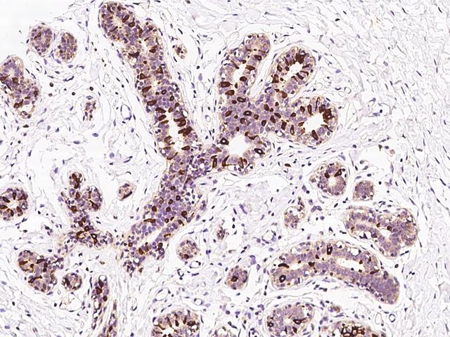 HELO1 / ELOVL5 Antibody - Immunochemical staining of human ELOVL5 in human breast with rabbit polyclonal antibody at 1:200 dilution, formalin-fixed paraffin embedded sections.