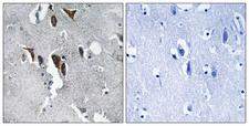 HELO1 / ELOVL5 Antibody - Peptide - + Immunohistochemistry analysis of paraffin-embedded human brain tissue using ELOVL5 antibody.