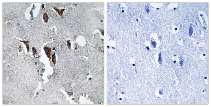 HELO1 / ELOVL5 Antibody - Peptide - + Immunohistochemistry analysis of paraffin-embedded human brain tissue using ELOVL5 antibody.