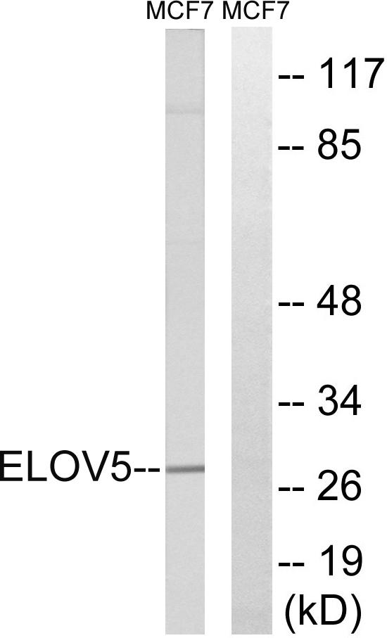 HELO1 / ELOVL5 Antibody - Western blot analysis of extracts from MCF-7 cells, using ELOVL5 antibody.