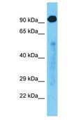 HELQ / HEL308 Antibody - HELQ / HEL308 antibody Western Blot of Fetal Lung. Antibody dilution: 1 ug/ml.  This image was taken for the unconjugated form of this product. Other forms have not been tested.